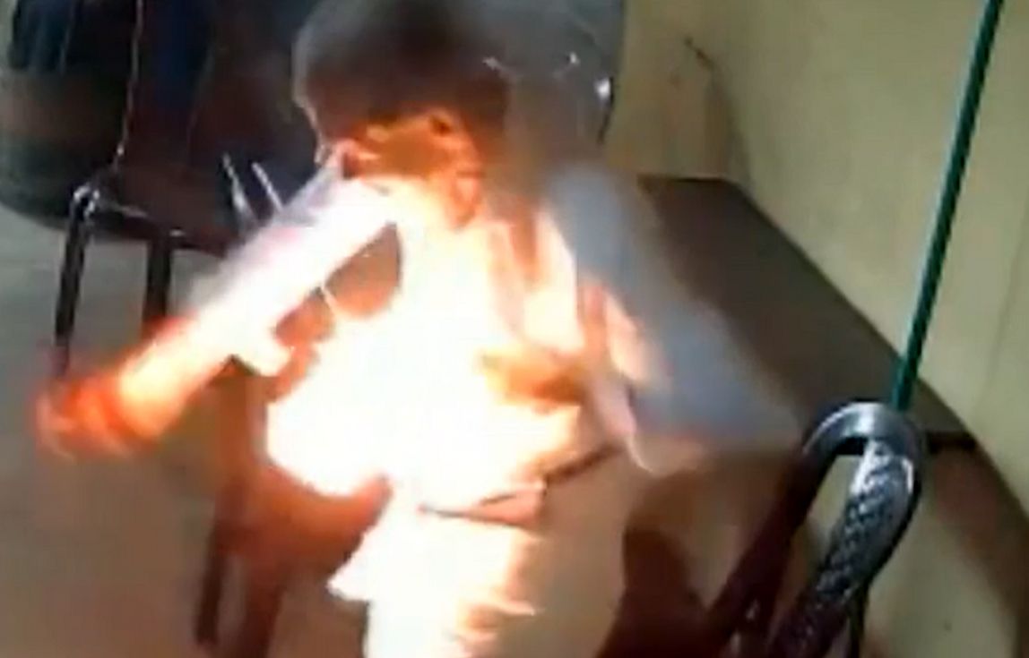انفجار ناگهانی موبایل در جیب یک پیرمرد