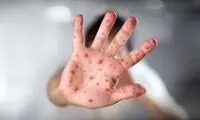 خطری که مسافران ایرانیِ اربعین را تهدید می‌کند