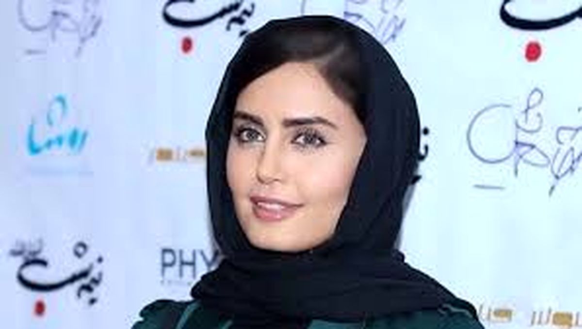 شباهت عجیب الناز شاکردوست به جرد لتو خبرساز شد