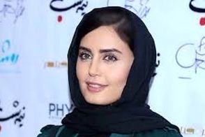 شباهت عجیب الناز شاکردوست به جرد لتو خبرساز شد