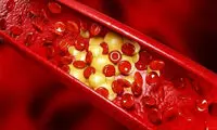 این اتفاق باعث بالا رفتن چربی خون می‌شود