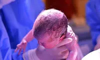 تغییر چهره عجیب و حیرت‌انگیز زن جوان بعد زایمان