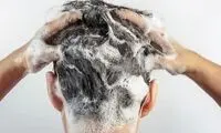 علت ریزش مو در حمام چیست؟