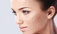 لیفت صورت با نخ | کاربرد، مراحل، مزایا، معایب، ماندگاری و هزینه