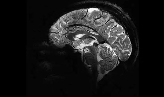 تصاویر خیره‌کننده مغز انسان در قوی‌ترین دستگاه MRI جهان