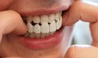 این تصویر عجیب به هر چیزی شبیه است غیر از دندان‌سازی!