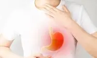چند نکته درباره سوزش ناگهانی سر دل