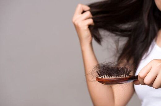 چگونه بدانیم ریزش موی سر ما غیرطبیعی است؟