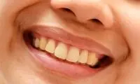 چرا رنگ دندانم تغییر کرد؟