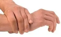 اگر خواب رفتگی مچ دست دارید، بخوانید