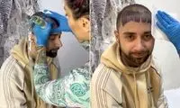 گاف عجیب یک تَتوکار روی پیشانی پسر جوان