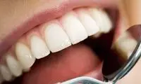 چند توصیه مهم برای سلامت دهان و دندان در روزه داری