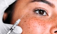 درمان پی آر اف PRF چگونه باعث جوانسازی پوست می‌شود؟