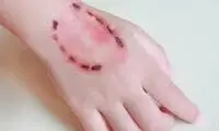 تصویری جالب و دیده نشده از لحظه گاز گرفتن!