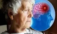 کدام ویژگی شخصیتی زوال عقل را افزایش می‌دهد؟