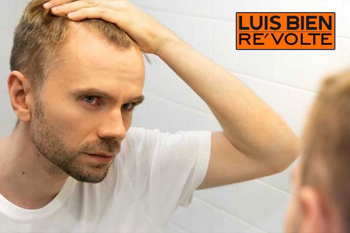 راه حل ریزش مو در مردان و زنان
