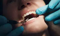 بیماری لثه خطر زوال عقل را افزایش می‌دهد