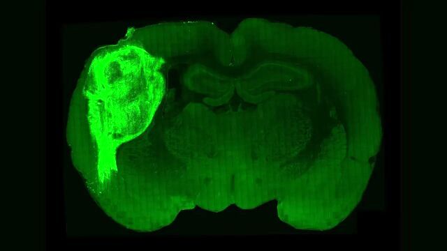 پرورش سلول‌های مغزی انسان در مغز موش