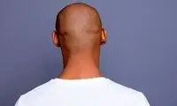 چند مرد کچل یک آرایشگر را راهی زندان کردند!