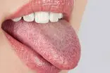 رنگ زبان شما چه هشداری درباره سلامت بدنتان می‌دهد؟