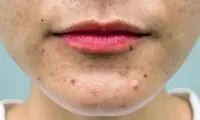 چیزهای عجیبی که نمی دانستید به پوست صدمه می زنند