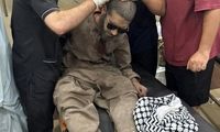 تصاویری از مجروحان حمله موشکی امشب هند