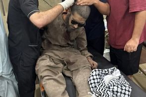تصاویری از مجروحان حمله موشکی امشب هند
