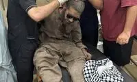 تصاویری از مجروحان حمله موشکی امشب هند