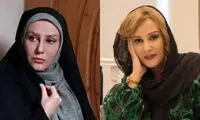 تغییر چهره این بازیگر ایرانی سوژه شد