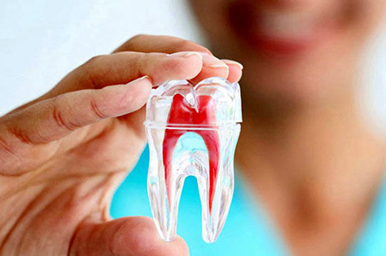 آشنایی با انواع روش‌ های درمان ریشه دندان