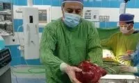 خارج کردن توده ۳/۵ کیلویی از کلیه یک بیمار!