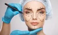 دماغ ایرانی‌ ها در جهان سوژه شد!