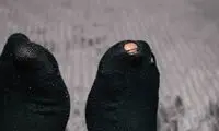 جوراب‌ سوراخ برای تابستان امسال مُد شد!