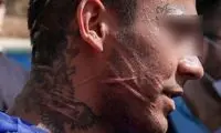 خالکوبی و زخم‌های عجیب روی صورت یک اوباش