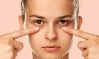 چند راهکار فوری برای رفع پف زیر چشم