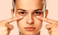 چند راهکار فوری برای رفع پف زیر چشم