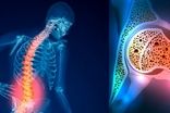 این بیماری از دهه چهارم زندگی شروع می‌شود