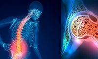 این بیماری از دهه چهارم زندگی شروع می‌شود