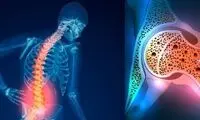 این بیماری از دهه چهارم زندگی شروع می‌شود