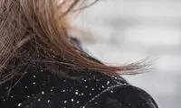 اگر شوره دارید، شب‌ها این کار ساده را فراموش نکنید!