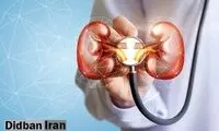 ابتلای ۷۴هزار نفر به این بیماری در کشور