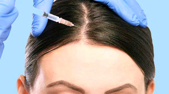 مزوتراپی مو چیست و چه فوایدی برای درمان ریزش مو دارد؟
