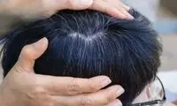 یافته‌ای جدید درباره سفید شدن مو