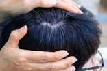 یافته‌ای جدید درباره سفید شدن مو