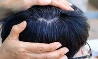 یافته‌ای جدید درباره سفید شدن مو