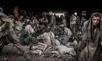 اگر شیشه مصرف کنید، این شکلی می‌شوید!