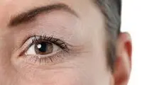 خطوط صورت درباره کدام بیماری‌ها هشدار می‌دهند؟