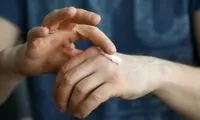 مراقب این تغییرات پاییزی در بدن باشید