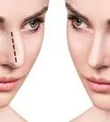 جراحی بینی بدون درد و کبودی چگونه امکان‌پذیر است؟