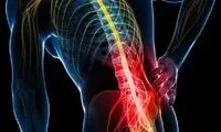 حذف این سه عامل کمردردتان را کاهش می‌‌دهد